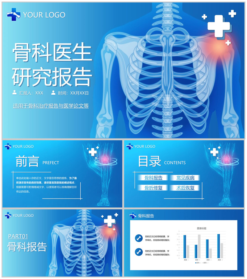 蓝色简洁骨科医生治疗研究报告医学论文答辩PPT模板